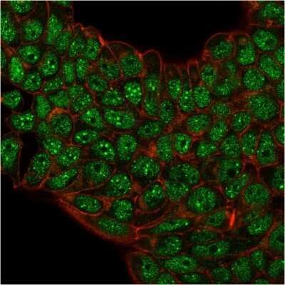 Immunocytochemistry/ Immunofluorescence: SUMO2/3 Antibody (SM23/496) - Azide and BSA Free [NBP2-34717]