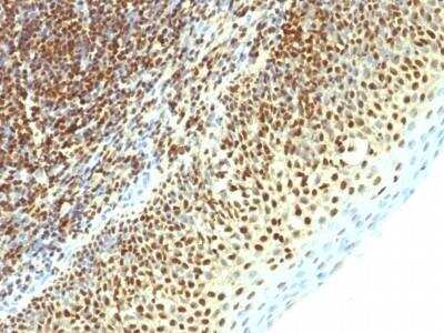 Immunohistochemistry-Paraffin: SUMO2 Antibody (SPM621) - Azide and BSA Free [NBP2-47711]