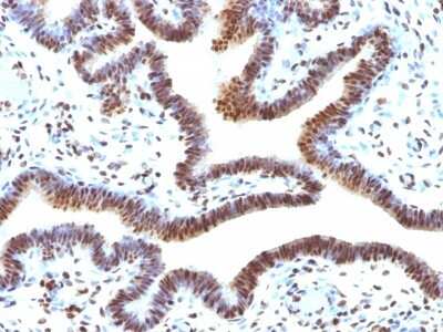 Immunohistochemistry-Paraffin: SUMO2 Antibody (SUMO2/1199) [NBP2-44477]