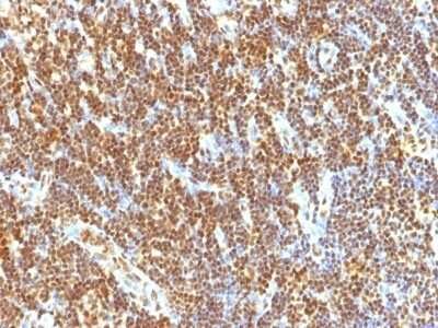 Immunohistochemistry-Paraffin: SUMO2 Antibody (SUMO2/1199) [NBP2-44477]