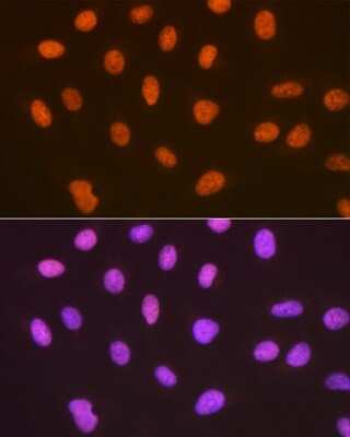 Immunocytochemistry/ Immunofluorescence: SUMO4 Antibody (7X3V7) [NBP3-16732]