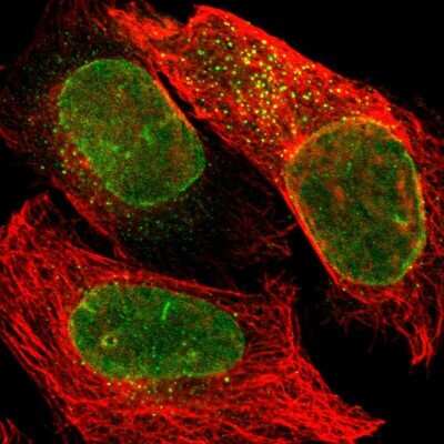 Immunocytochemistry/ Immunofluorescence: SUN1 Antibody [NBP1-87395]