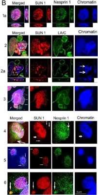 Immunocytochemistry/ Immunofluorescence: SUN1 Antibody [NBP1-87396]