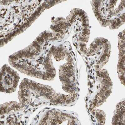 Immunohistochemistry-Paraffin: SUN1 Antibody [NBP1-87395]