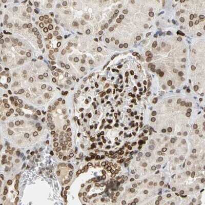 Immunohistochemistry-Paraffin: SUN1 Antibody [NBP1-87395]