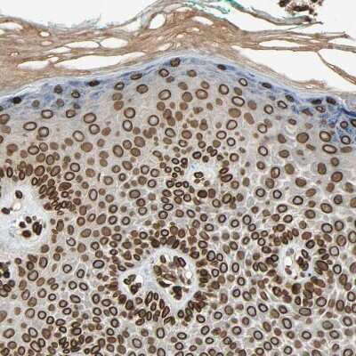 Immunohistochemistry-Paraffin: SUN1 Antibody [NBP1-87395]