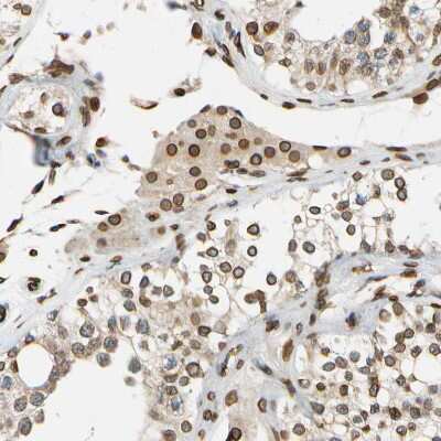 Immunohistochemistry-Paraffin: SUN1 Antibody [NBP1-87395]