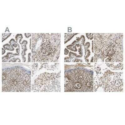 Immunohistochemistry-Paraffin: SUN1 Antibody [NBP1-87396]