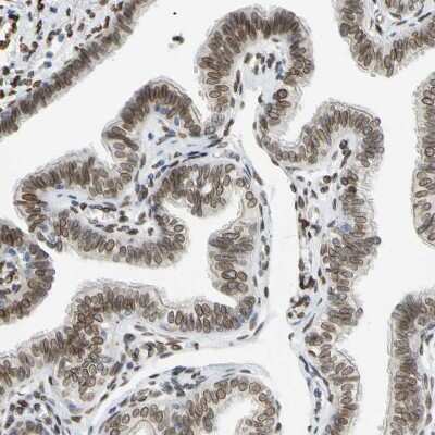 Immunohistochemistry-Paraffin: SUN1 Antibody [NBP1-87396]