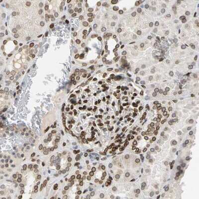 Immunohistochemistry-Paraffin: SUN1 Antibody [NBP1-87396]