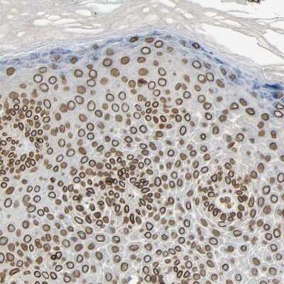 Immunohistochemistry-Paraffin: SUN1 Antibody [NBP1-87396]