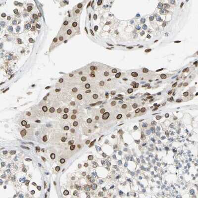 Immunohistochemistry-Paraffin: SUN1 Antibody [NBP1-87396]
