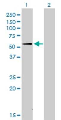 Western Blot: SUOX Antibody (1H1) [H00006821-M01]
