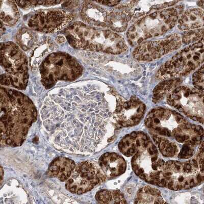 Immunohistochemistry-Paraffin: SUOX Antibody [NBP2-38396]
