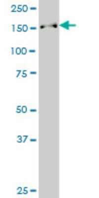 Western Blot: SUPT16H Antibody (1D12) [H00011198-M01]