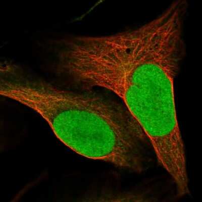 Immunocytochemistry/ Immunofluorescence: SUPT16H Antibody [NBP2-38607]