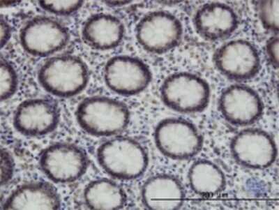 Immunohistochemistry-Paraffin: SUPT5H Antibody (3F1) [H00006829-M01]