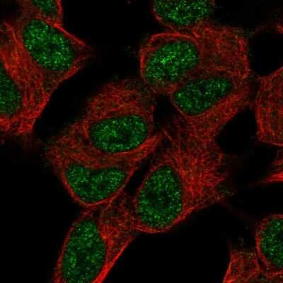 Immunocytochemistry/ Immunofluorescence: SUPT7L Antibody [NBP2-57671]