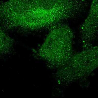 Immunocytochemistry/ Immunofluorescence: SUR-8 Antibody [NBP1-87831]