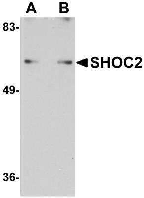 Western Blot: SUR-8 AntibodyBSA Free [NBP1-77041]