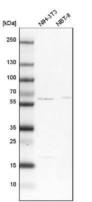 Western Blot: SUR-8 Antibody [NBP1-87831]