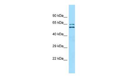 Western Blot: SUR-8 Antibody [NBP2-88383]