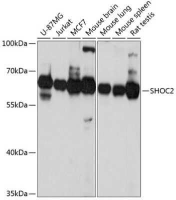 Western Blot: SUR-8 AntibodyAzide and BSA Free [NBP2-94883]