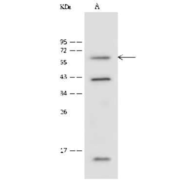 Western Blot: SUR-8 Antibody [NBP2-99515]
