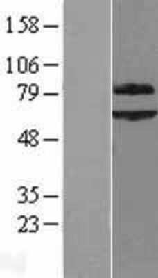 Western Blot: SUR-8 Overexpression Lysate [NBL1-15949]