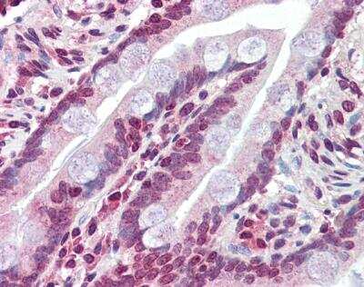 Immunohistochemistry-Paraffin: SUR1 Antibody [NBP1-59778]