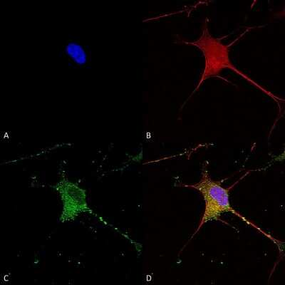 Immunocytochemistry/ Immunofluorescence: SUR1 Antibody (S289-16) [NBP2-59320]