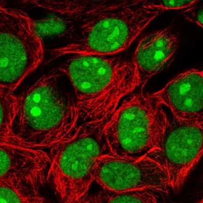Immunocytochemistry/ Immunofluorescence: SURF2 Antibody [NBP2-13400]