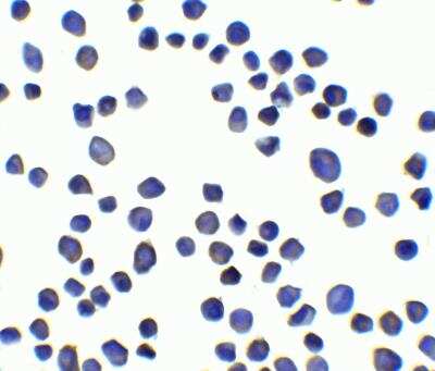 Immunocytochemistry/ Immunofluorescence: SUSD3 Antibody - BSA Free [NBP2-82017]