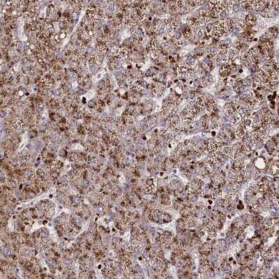 Immunohistochemistry-Paraffin: SUSD3 Antibody [NBP1-82723]