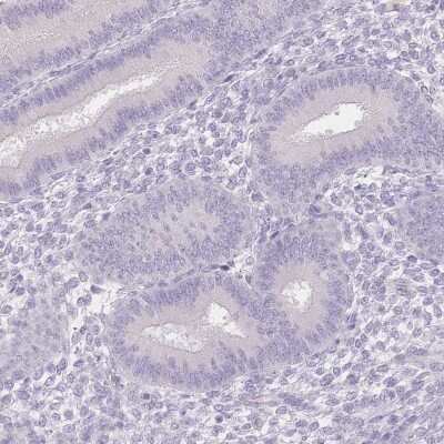 Immunohistochemistry-Paraffin: SUV39H2 Antibody [NBP2-38828]
