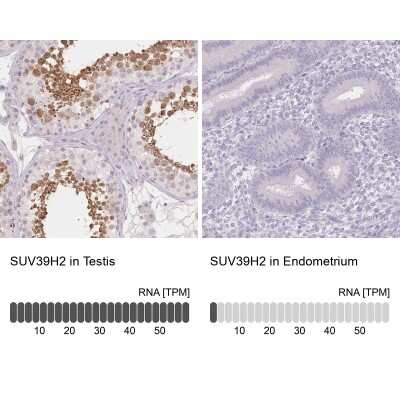 Immunohistochemistry-Paraffin: SUV39H2 Antibody [NBP2-38828]
