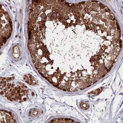 Immunohistochemistry-Paraffin: SUV3L1 Antibody [NBP1-80711]