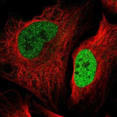 Immunocytochemistry/ Immunofluorescence: SUV420H2 Antibody [NBP2-30524]