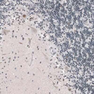 Immunohistochemistry-Paraffin: SUV420H2 Antibody [NBP2-30524]