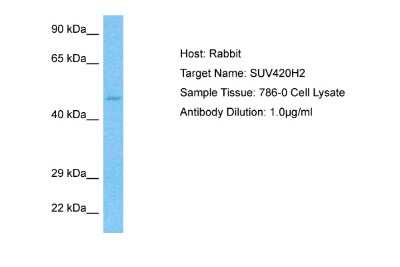 Western Blot: SUV420H2 Antibody [NBP2-83606]