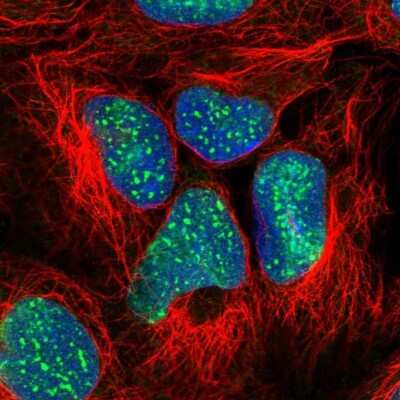Immunocytochemistry/ Immunofluorescence: SUZ12 Antibody [NBP2-33834]