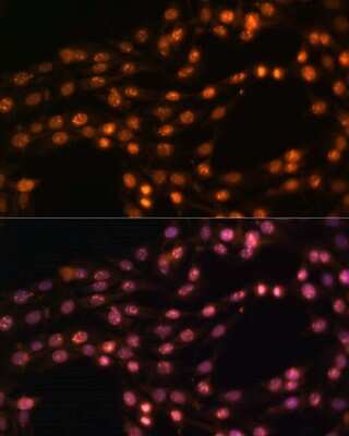 Immunocytochemistry/ Immunofluorescence: SUZ12 Antibody - BSA Free [NBP3-03738]