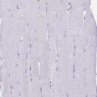 Immunohistochemistry-Paraffin: SUZ12 Antibody [NBP2-33834]