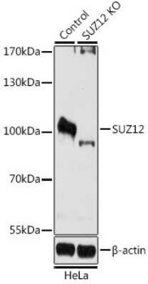 Knockout Validated: SUZ12 Antibody - BSA Free [NBP3-03738]