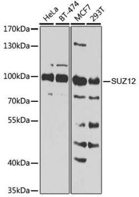 Western Blot: SUZ12 AntibodyBSA Free [NBP3-03738]