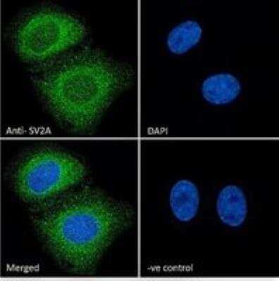 Immunocytochemistry/ Immunofluorescence: SV2A Antibody [NB100-41402]