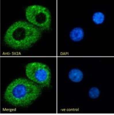 Immunocytochemistry/ Immunofluorescence: SV2A Antibody [NB100-41402]