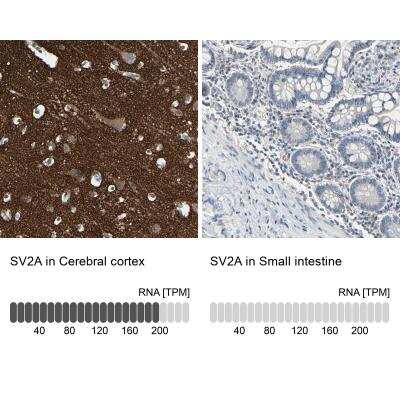 Immunohistochemistry-Paraffin: SV2A Antibody [NBP1-82964]
