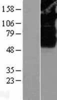 Western Blot: SV2B Overexpression Lysate [NBL1-16631]
