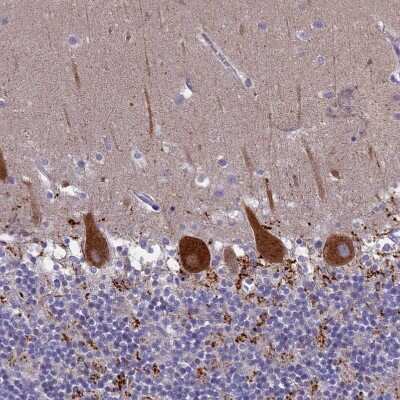 Immunohistochemistry-Paraffin: SV2C Antibody [NBP1-86239]
